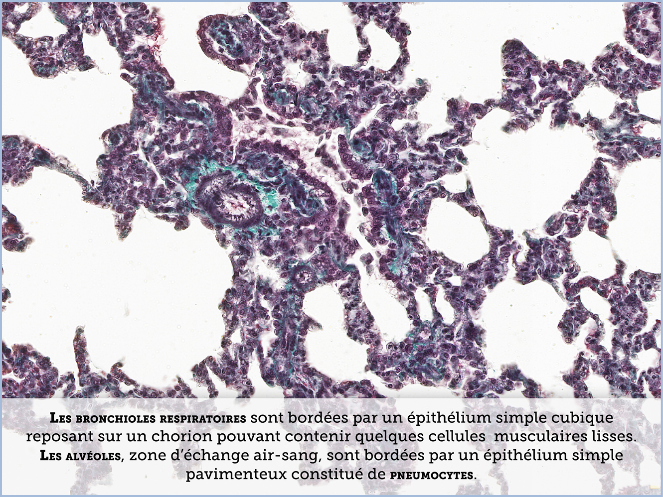 FICHE 2 TUMEUR WARTHIN ECRAN A