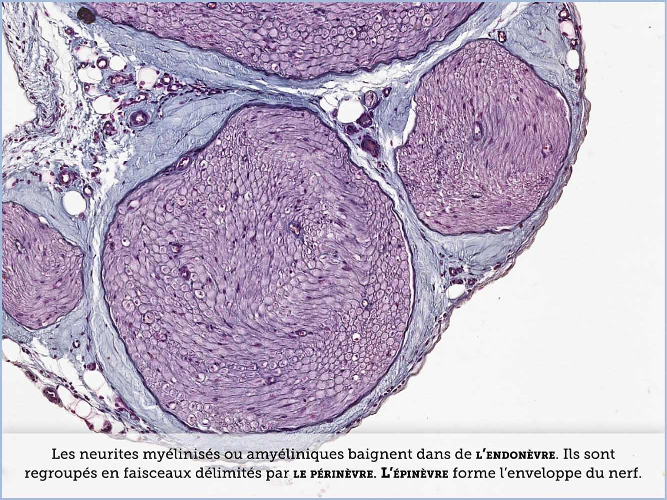 FICHE 2 TUMEUR WARTHIN VIDEO