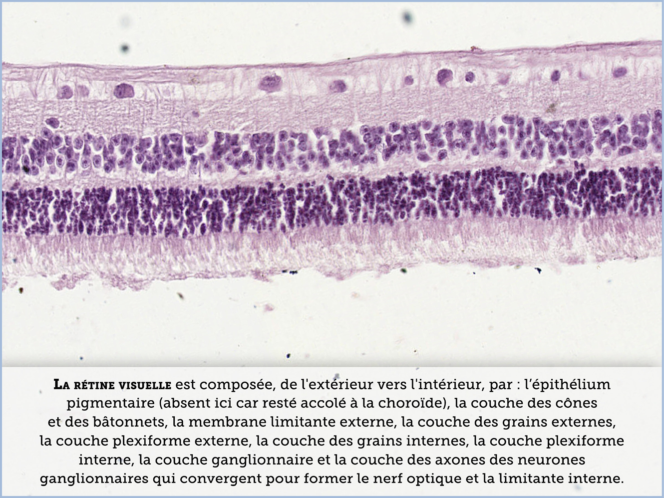 FICHE 2 TUMEUR WARTHIN ECRAN A