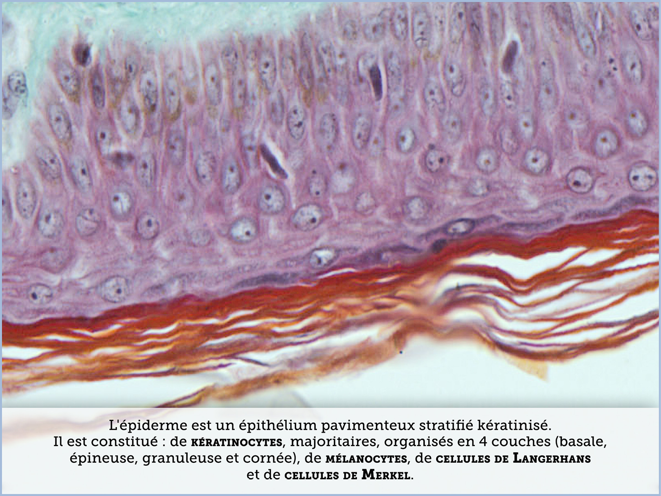 FICHE 2 TUMEUR WARTHIN VIDEO