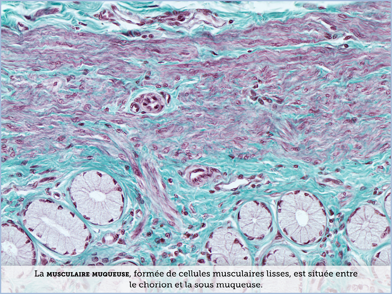 FICHE 2 TUMEUR WARTHIN ECRAN B