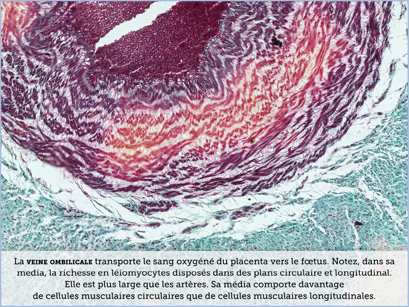 FICHE 2 TUMEUR WARTHIN VIDEO