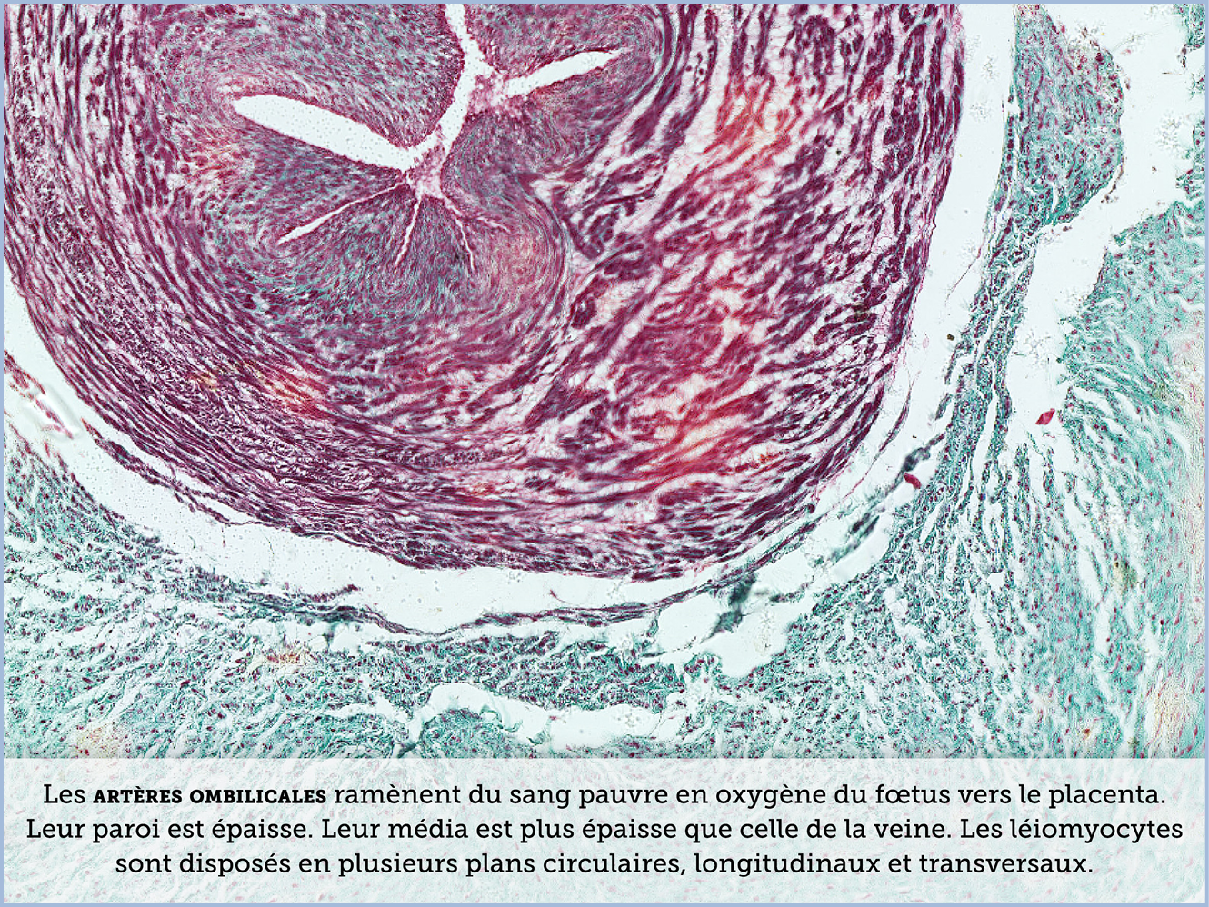 FICHE 2 TUMEUR WARTHIN ECRAN C