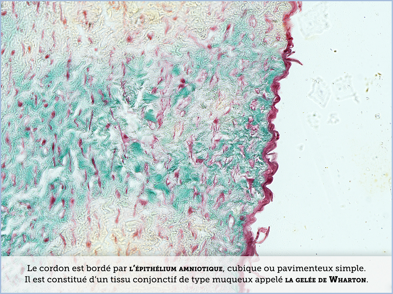 FICHE 2 TUMEUR WARTHIN ECRAN B