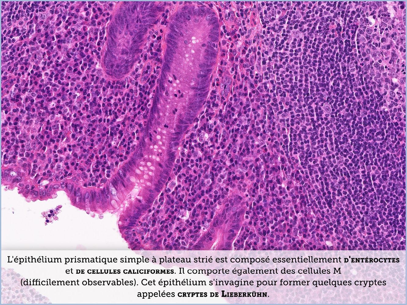 FICHE 2 TUMEUR WARTHIN VIDEO