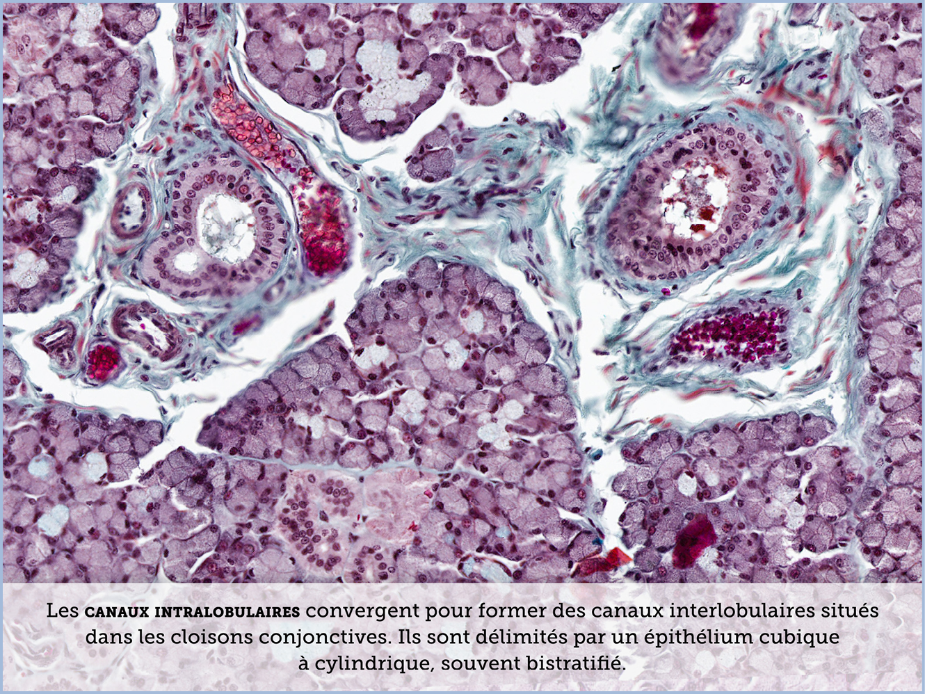 FICHE 2 TUMEUR WARTHIN ECRAN A