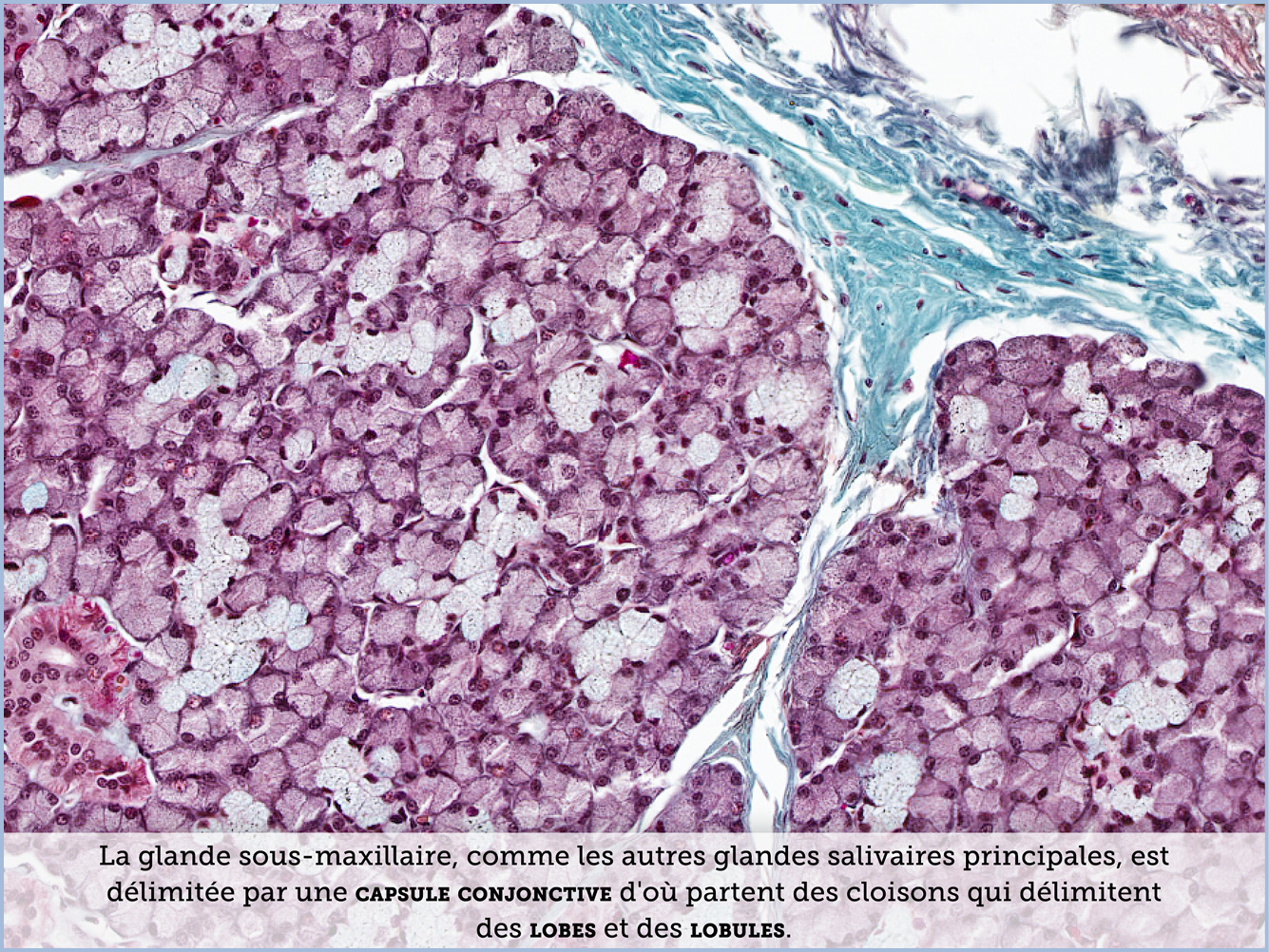 FICHE 2 TUMEUR WARTHIN VIDEO