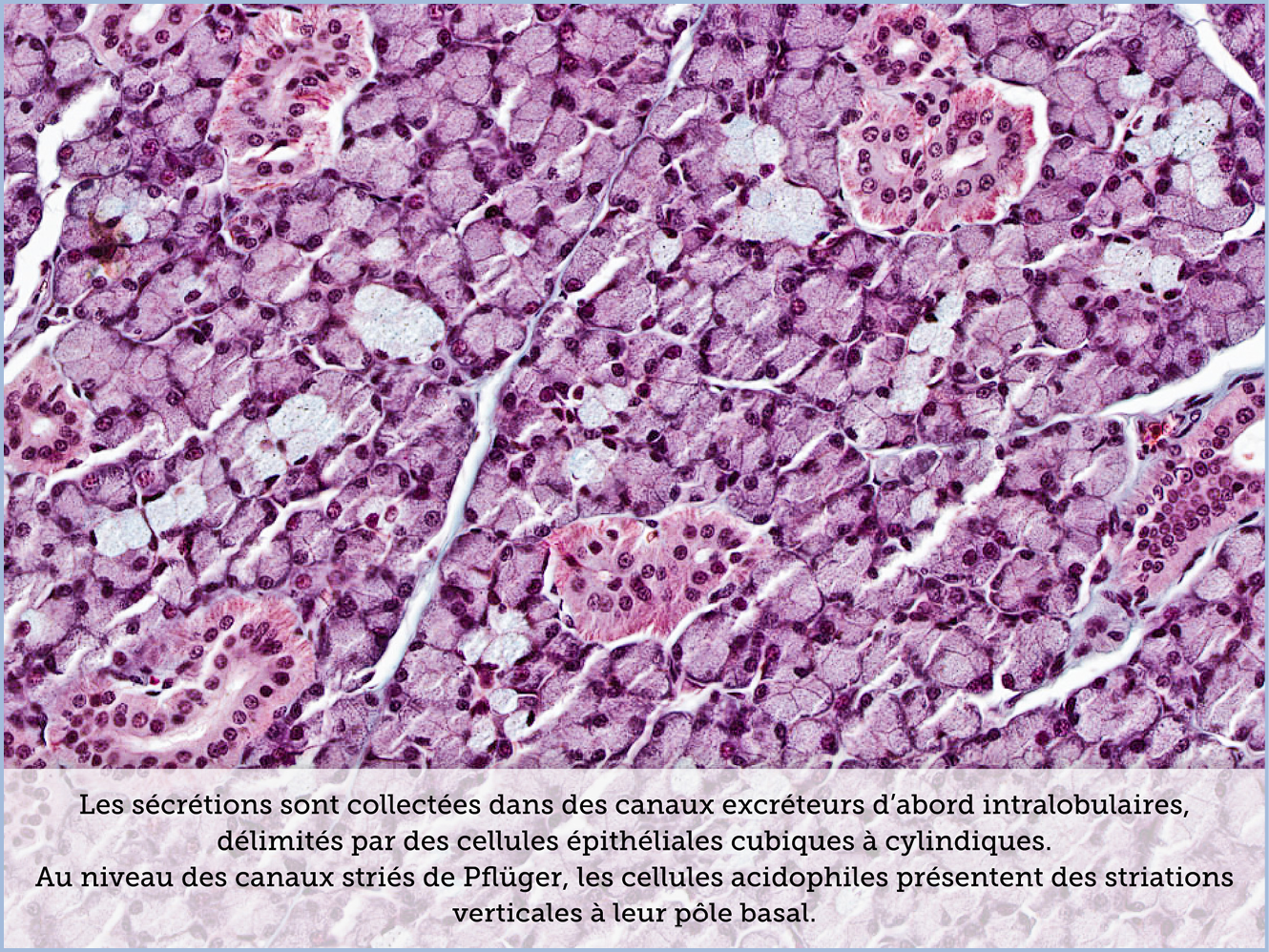 FICHE 2 TUMEUR WARTHIN ECRAN B