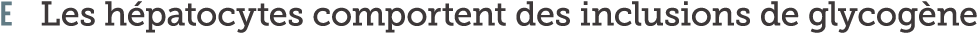 E Les h patocytes comportent des inclusions de glycog ne